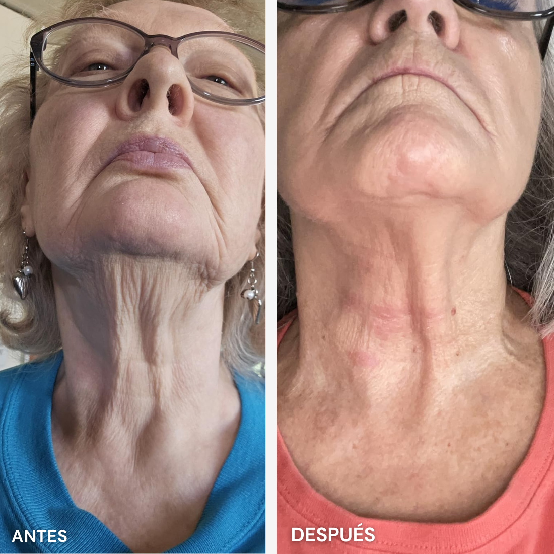 Serum Pilar