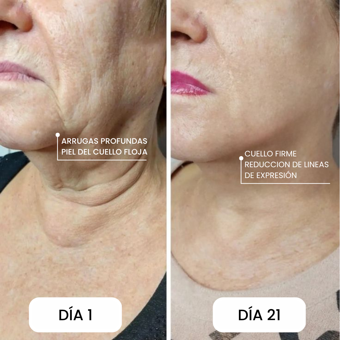 Serum Pilar