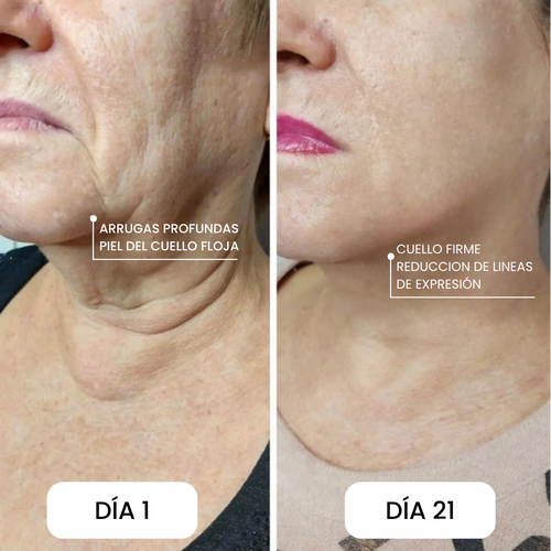 Serum Pilar
